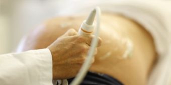 Schwangere beim Ultraschall in der Geburtshilfe