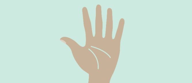 Bild: Illustration der Asklepios Kliniken zum Thema Hand
