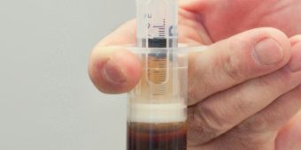 Eigenbluttherapie Spritze mit Blutplasma