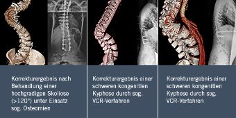 Korrekturergebnisse