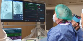 Herzchirurgen schauen auf einen Monitor, auf dem eine minimalinvasive Pulmonalvenenisolation zu sehen ist