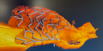 Das Bild zeigt ein Herzgefäß, das mittels Optischer Kohärenz-Tomographie sichtbar gemacht wurde