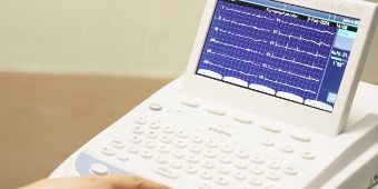 Das Bild zeigt ein EKG auf einem Monitor