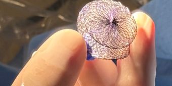 Das Bild zeigt den Doppelschirm in Detailansicht