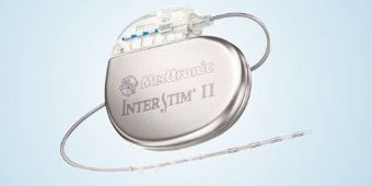 interstim-2