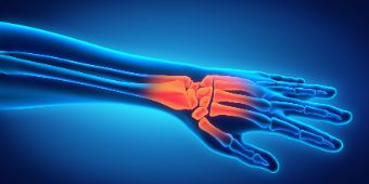 handgelenk-shutterstock