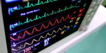 EKG Monitor 1 Daten Fakten