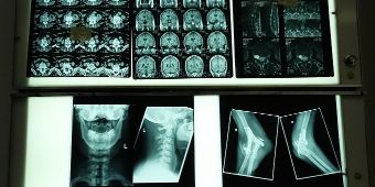 Du erstellst Röntgenaufnahmen von verschiedenen Körperteilen und kannst diese interpretieren Bild: Medizinische Röntgenbilder verschiedener Körperteile an einer Lichtwand