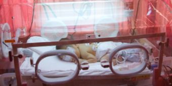Frühchen Foto eines Frühchens auf der Neonatologie