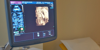 Präeklampsiescreening Präeklampsiescreening