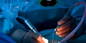 Mikrochirurgie Mikrochirurgie