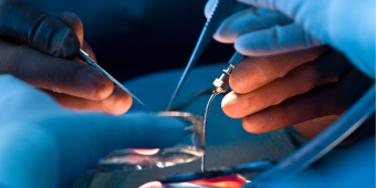 nervenrekonstruktion mikroskopische Operation