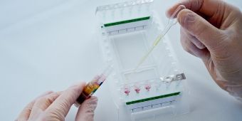 BILD: Blutwerte messen im Labor