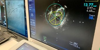 Intravaskuläre Bildgebung Intravaskuläre Bildgebung