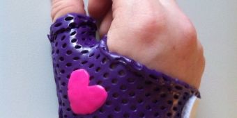 Mittelhandumgreifende Daumenorthese Kleinkind Ergotherapie