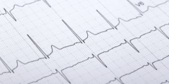 EGK Das Motiv zeigt ein EKG