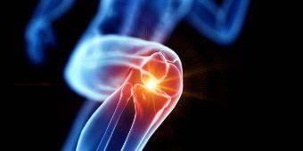 Das Motiv zeigt ein gezeichnet Knie