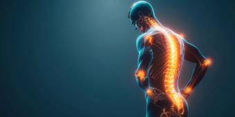 Das Motiv zeigt einen Mann, wo man die Wirbelsäule sieht