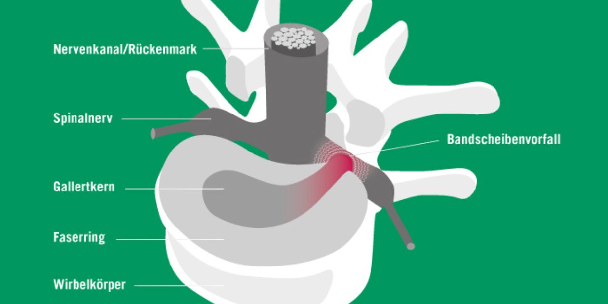 Aufbau der Wirbelsäule Asklepios Klinik Nord Heidberg