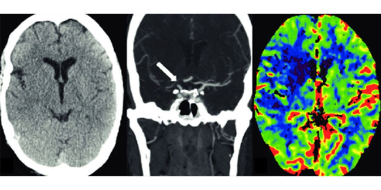 Stroke Unit Asklepios Klinik Schwalmstadt