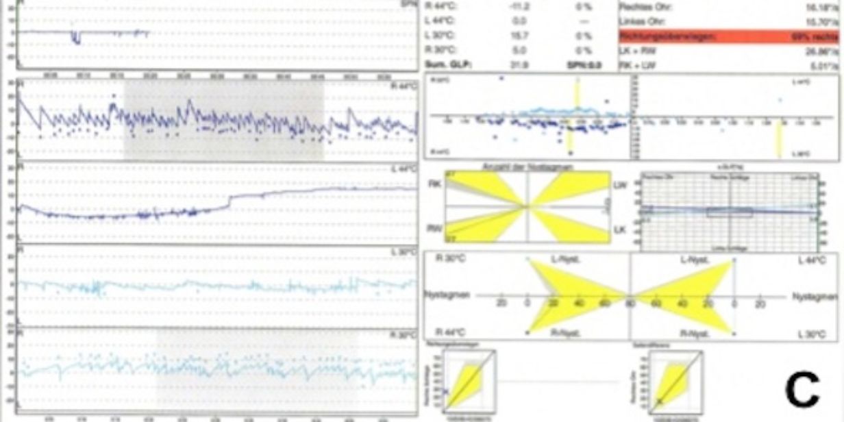 Schwindel- und Gleichgewichtsstörungen - Asklepios Klinik Schildautal ...