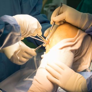 knie-eingriff-shutterstock