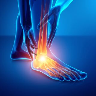 sprunggelenk-shutterstock sprunggelenk-shutterstock