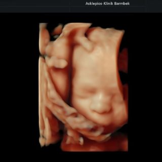 Ultraschal-in-3D