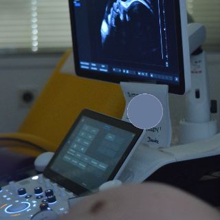 Monitor Ultraschall