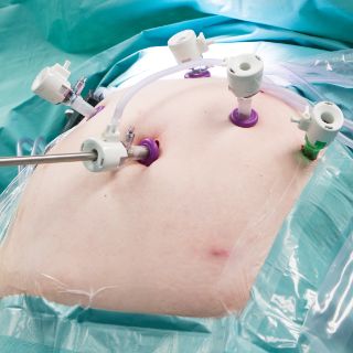 Bild: OP Dr. Albrecht - Bauch