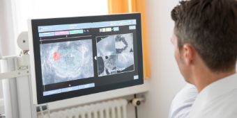 fusionsbiopsie 2018_08_14_asklepios__E6A2567