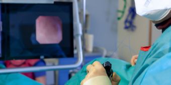 steinlaser 69_MG_9683_SMALL