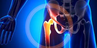 hueftgelenk-shutterstock