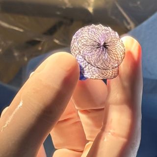 Das Bild zeigt den winzigen sogenannten Doppelschirm, der zum Verschluss des Lochs in der Herzwand eingesetzt wird