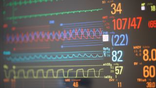 Bild: Werte auf dem Monitor