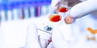 Transfusionsmedizin Blutgruppenkarte Transfusionsmedizin Blutgruppenkarte