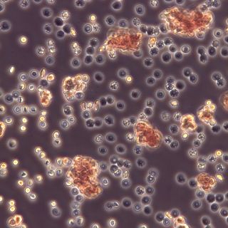 Mikroskopisches Bild einer immunhämatologischen Reaktion