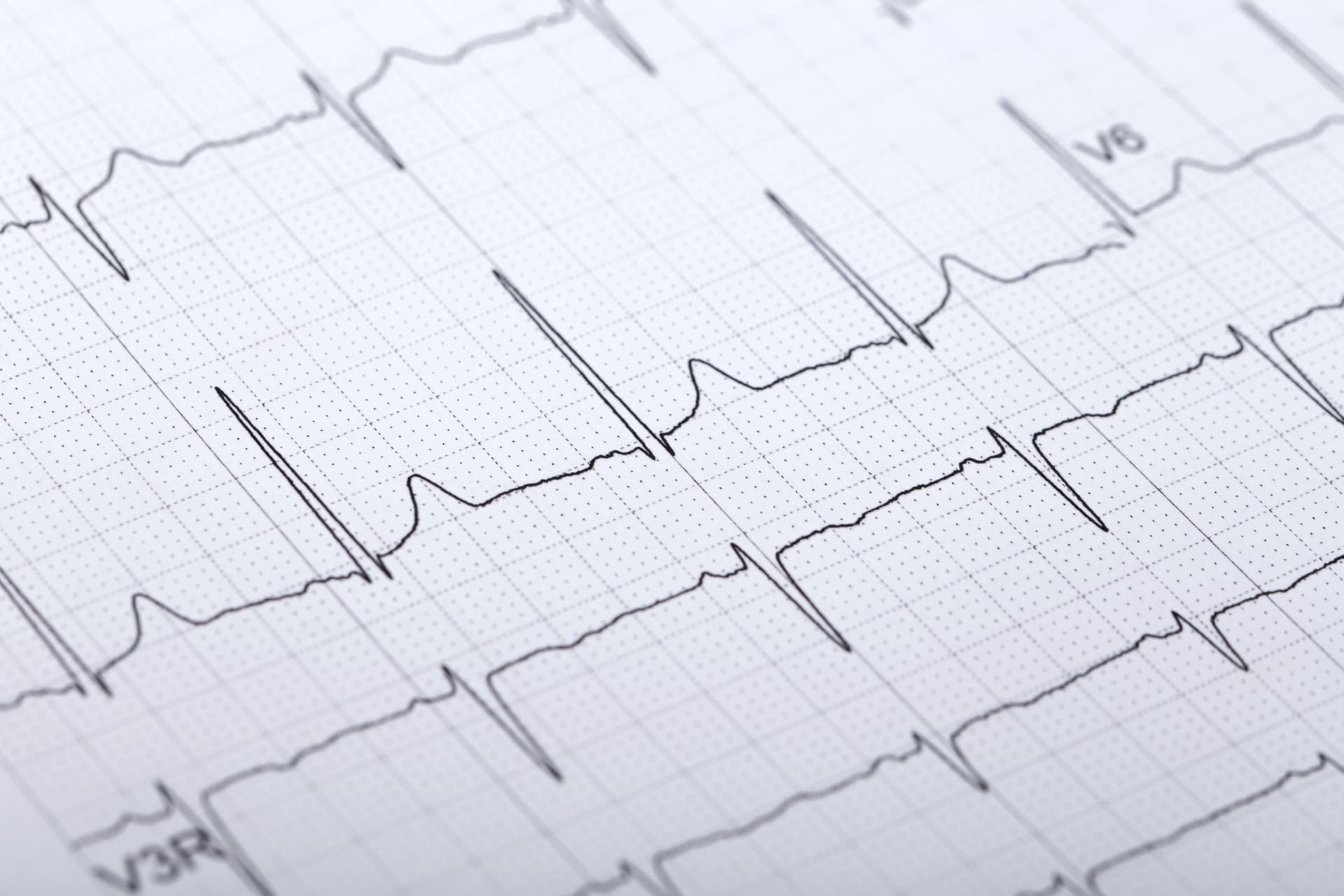 Das Motiv zeigt ein EKG