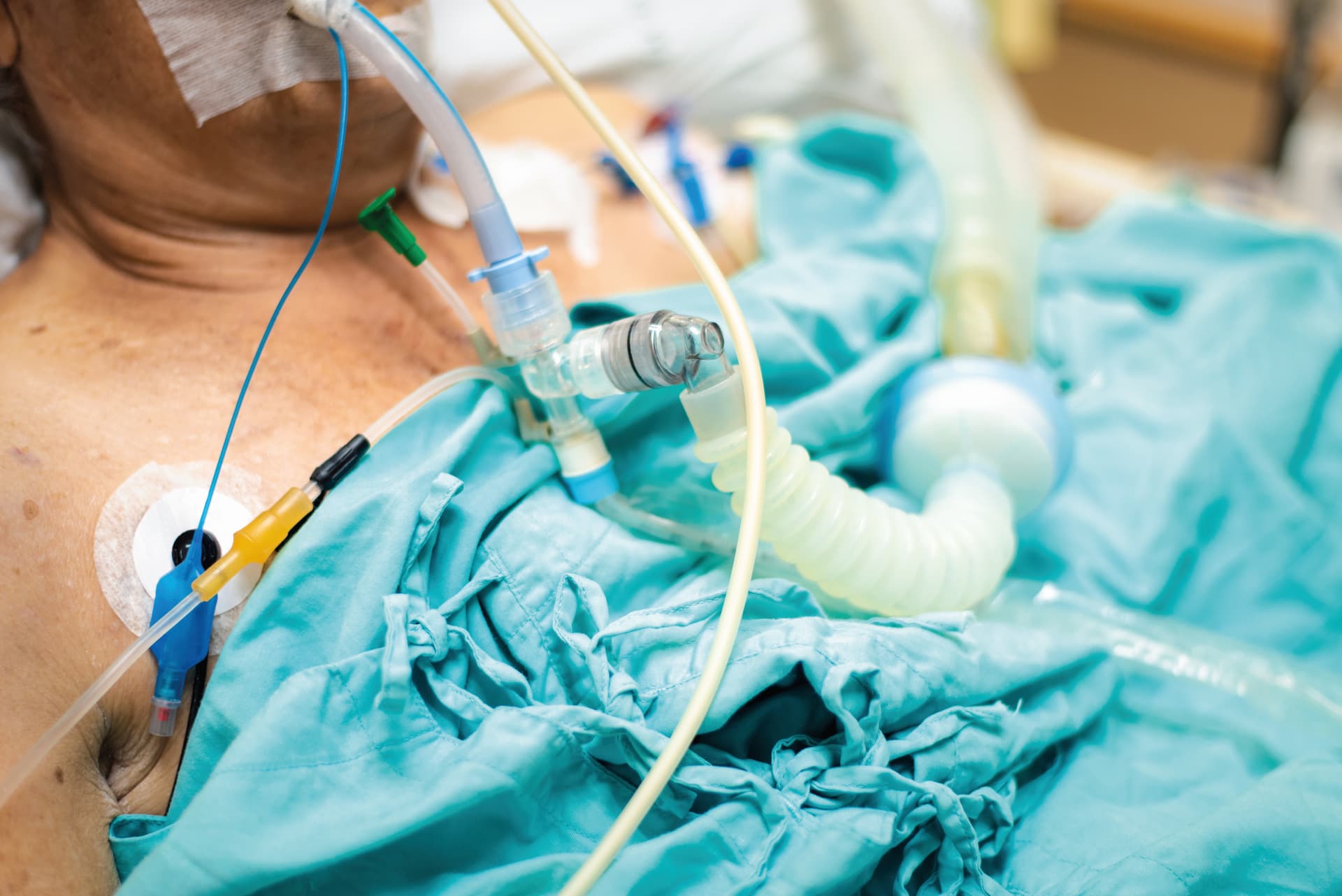 Das Motiv zeigt einen Patienten, der beatmet wird