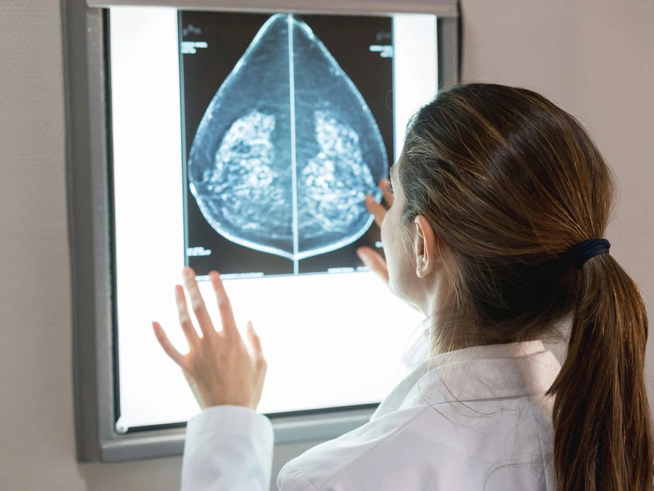 Bild: Ärztin beurteil Mammografie-Aufnahme