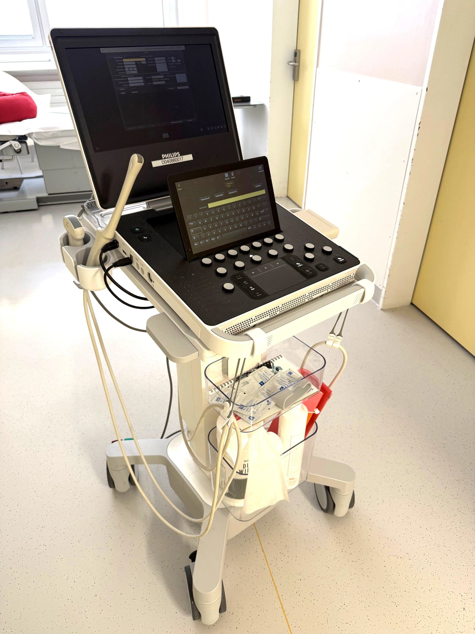 Das Motiv zeigt das neue Ultraschallgerät IPUS.