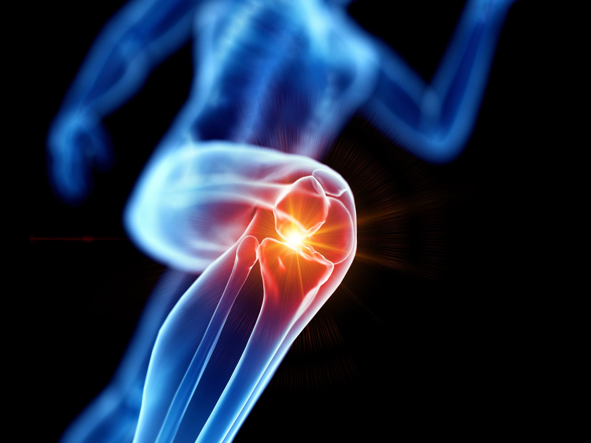 Das Motiv zeigt eine Figur mit einem Knie