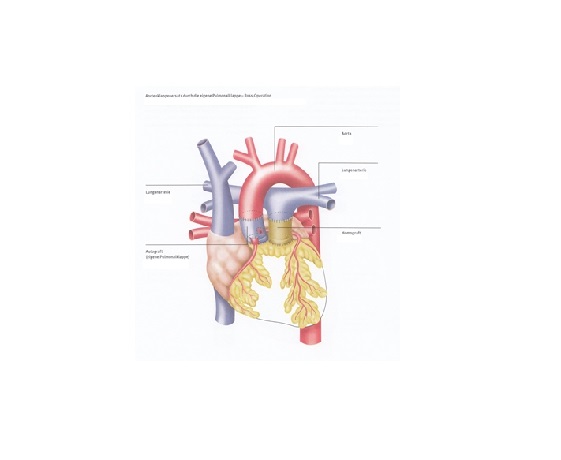 aortenklappenrekonstruktion_ross_dkhz_web aortenklappenrekonstruktion_ross_dkhz_web