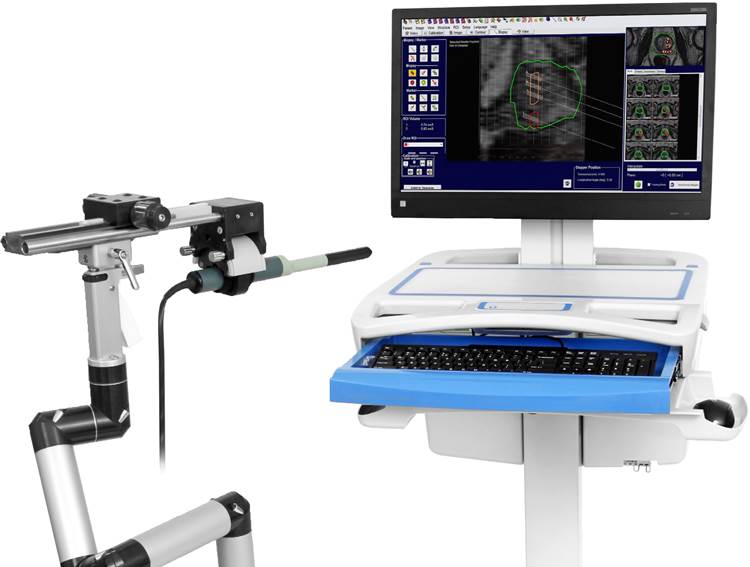 Fusionsbiopsie Neues Gerät in der Urologie