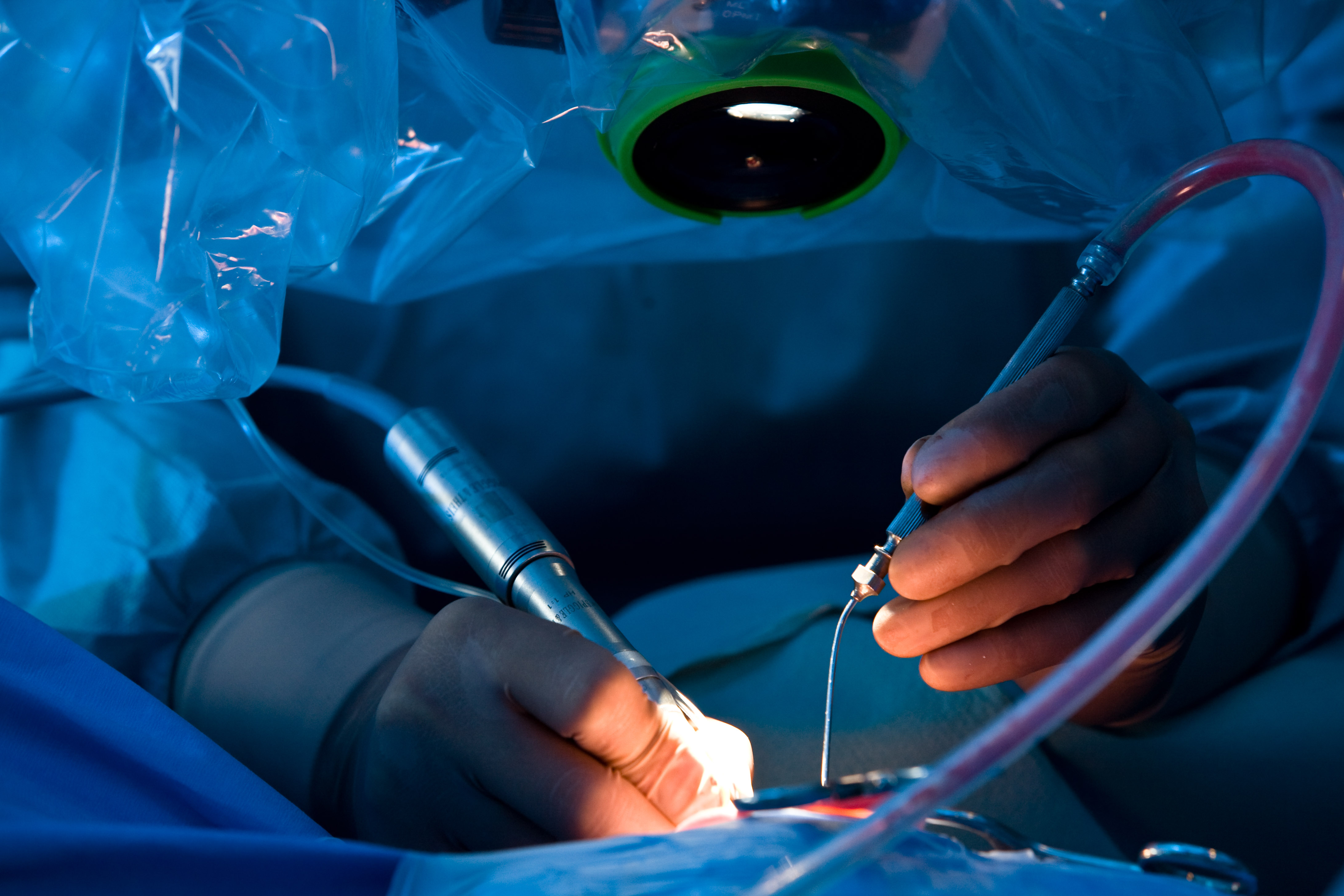 Mikrochirurgie, LASER und Computer NavigationsChirurgie  Asklepios