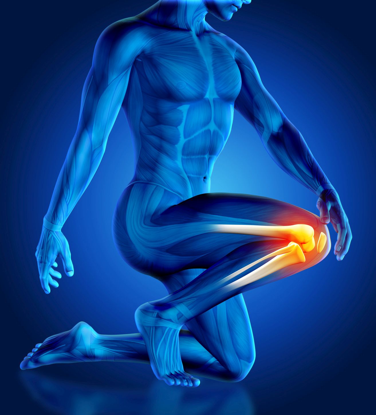 Knie Knie