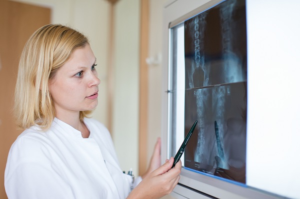 Ärztin schaut sich Röntgenbild an Diagnostik in der APK