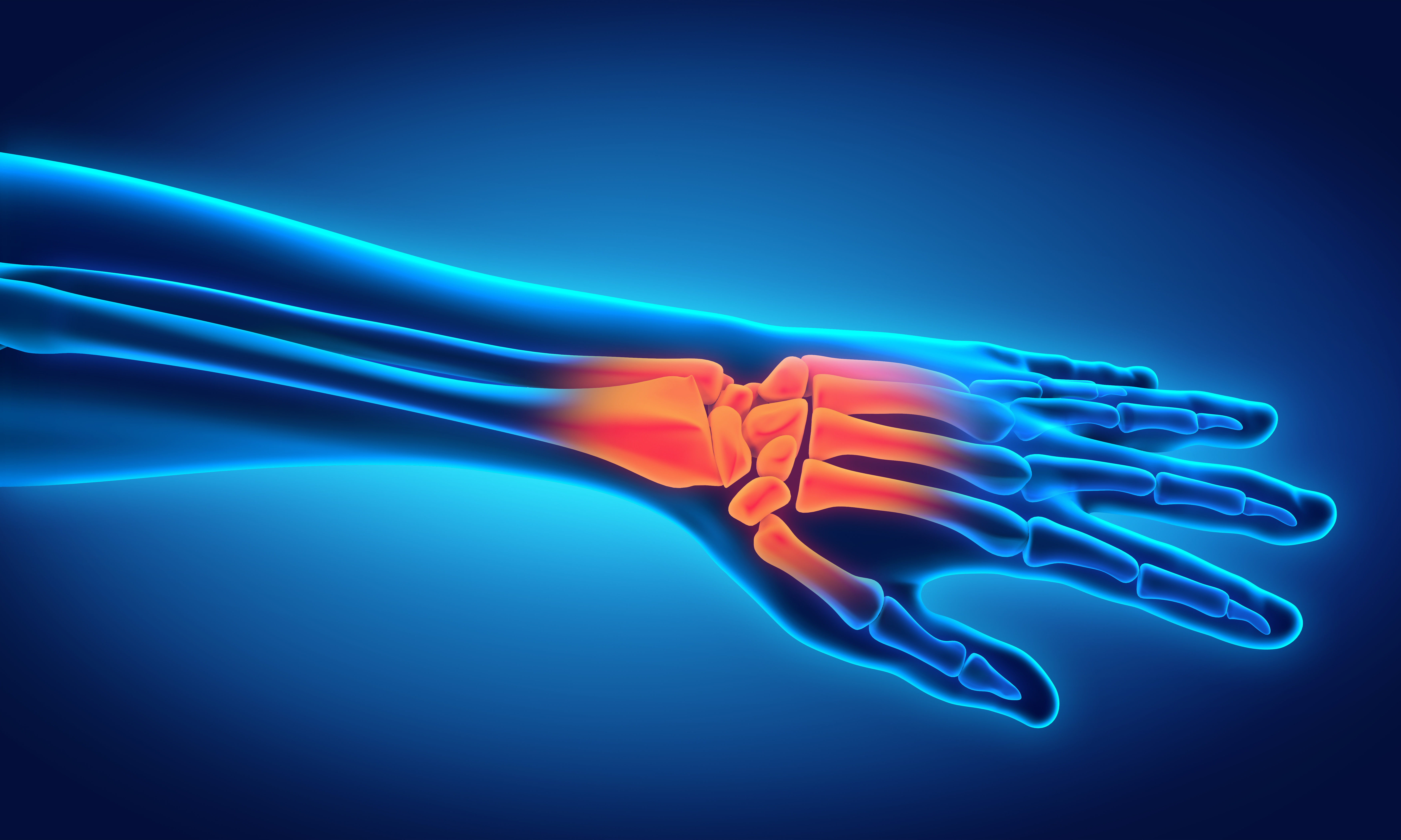 handgelenk-shutterstock handgelenk-shutterstock