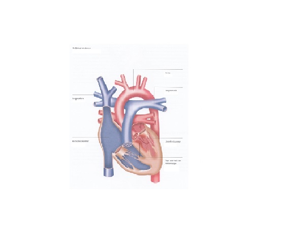 subaortenstenose_dkhz_web subaortenstenose_dkhz_web