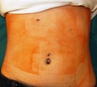 Bauch ACH_Leber 2_72